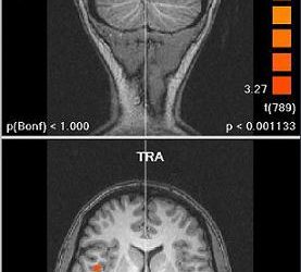 A Shadow Apart – Symposium on Biomedical Imaging