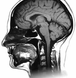 Magnetic Resonance