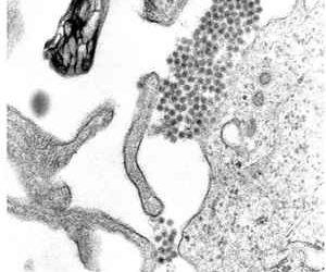 DENGUE FEVER