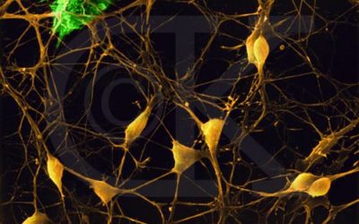 Brain-Like Computing