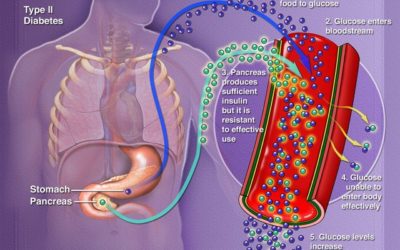 Video Lecture Series on Diabetes